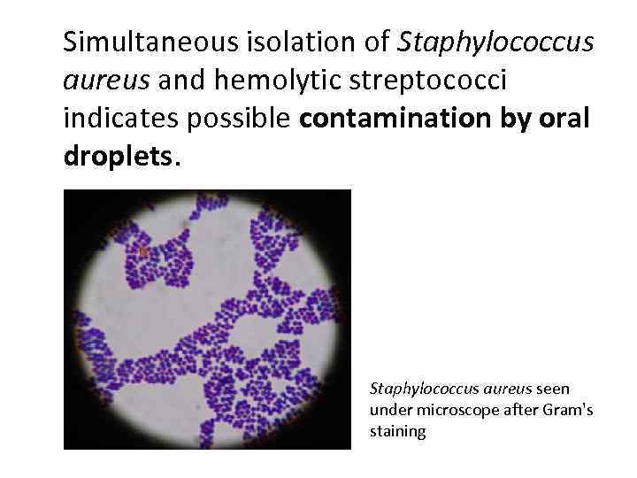 Simultaneous isolation of Staphylococcus aureus and hemolytic streptococci indicates possible contamination by oral droplets.