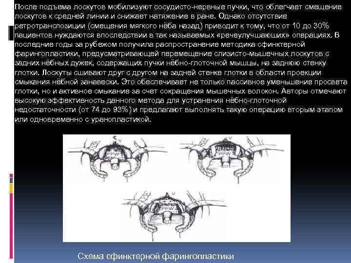 После подъема лоскутов мобилизуют сосудисто нервные пучки, что облегчает смещение лоскутов к средней линии