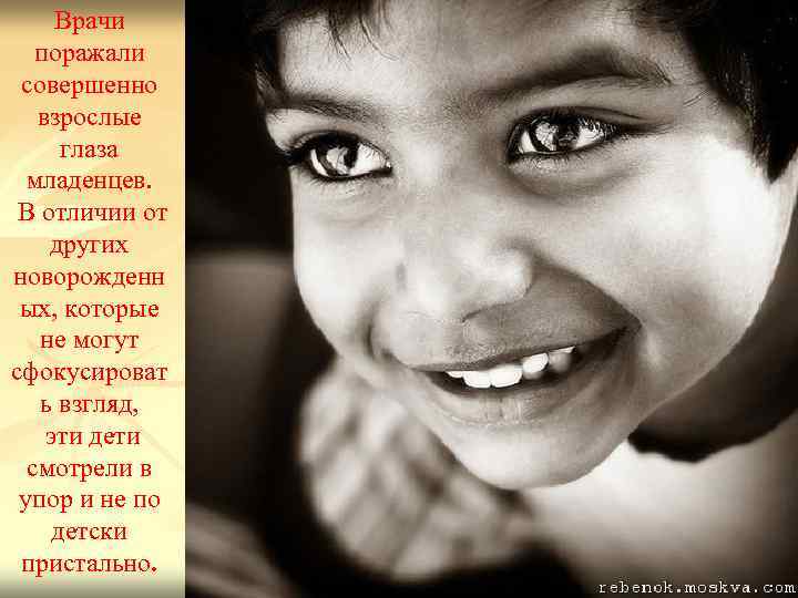 Врачи поражали совершенно взрослые глаза младенцев. В отличии от других новорожденн ых, которые не