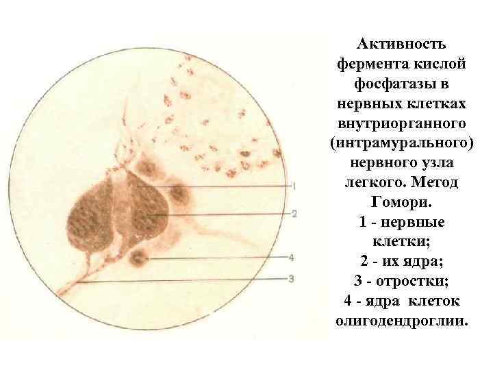Активность фермента кислой фосфатазы в нервных клетках внутриорганного (интрамурального) нервного узла легкого. Метод Гомори.