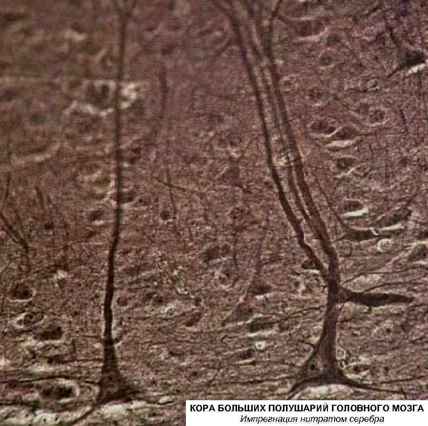 Кора больших полушарий гистология препарат рисунок