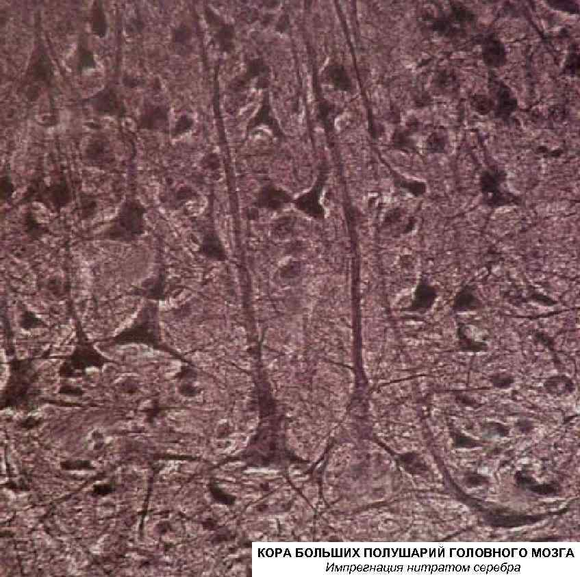 КОРА БОЛЬШИХ ПОЛУШАРИЙ ГОЛОВНОГО МОЗГА Импрегнация нитратом серебра 