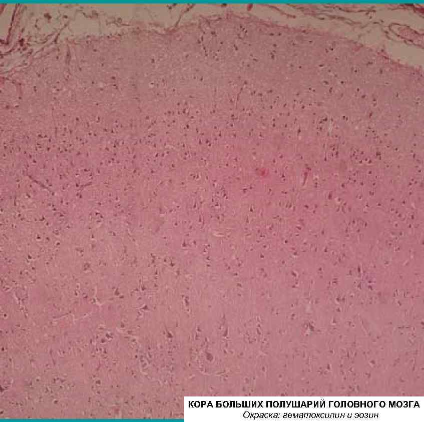 КОРА БОЛЬШИХ ПОЛУШАРИЙ ГОЛОВНОГО МОЗГА Окраска: гематоксилин и эозин 