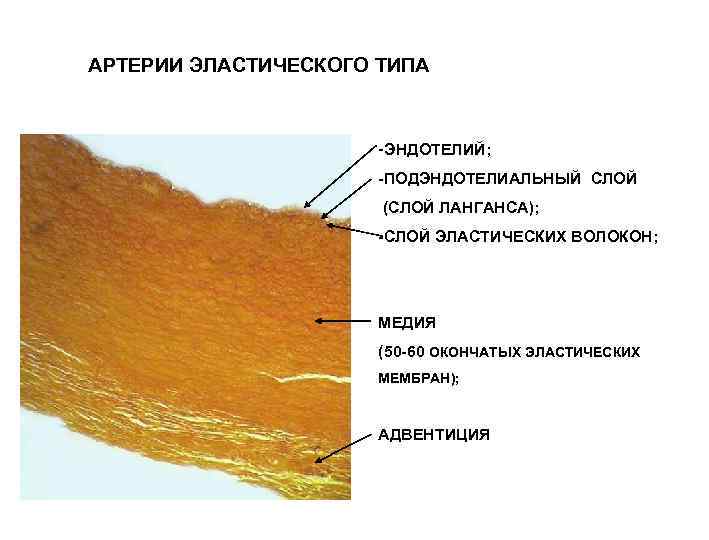 Артерия эластического типа рисунок