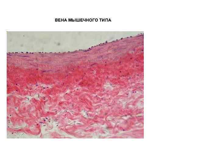 Вена препарат. Вена мышечного типа гистология. Бедренная Вена гистология. Вена мышечного типа бедренная Вена. Бедренная Вена препарат гистология.