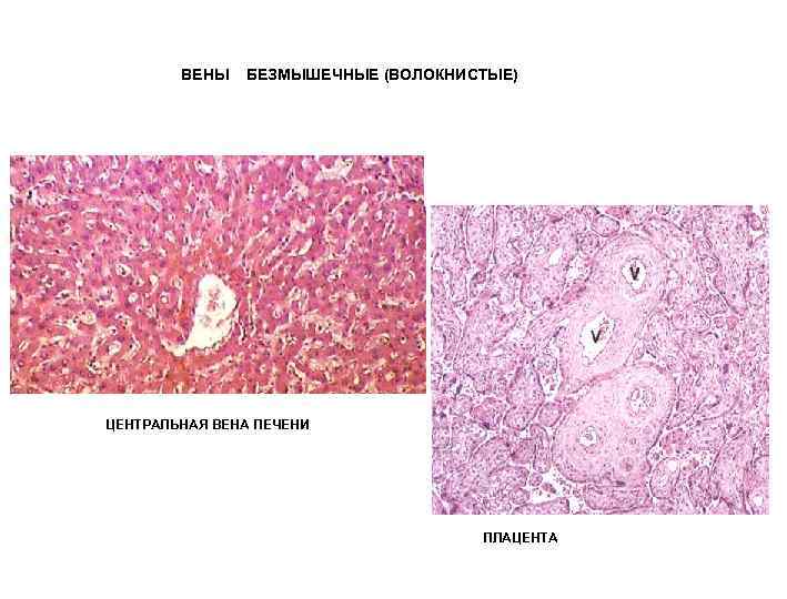 ВЕНЫ БЕЗМЫШЕЧНЫЕ (ВОЛОКНИСТЫЕ) ЦЕНТРАЛЬНАЯ ВЕНА ПЕЧЕНИ ПЛАЦЕНТА 