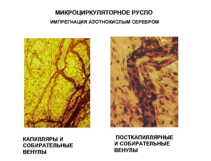 МИКРОЦИРКУЛЯТОРНОЕ РУСЛО ИМПРЕГНАЦИЯ АЗОТНОКИСЛЫМ СЕРЕБРОМ КАПИЛЛЯРЫ И СОБИРАТЕЛЬНЫЕ ВЕНУЛЫ ПОСТКАПИЛЛЯРНЫЕ И СОБИРАТЕЛЬНЫЕ ВЕНУЛЫ 