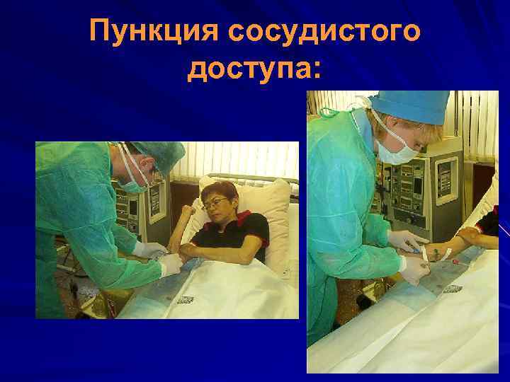 Пункция сосудистого доступа: 
