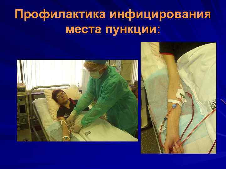 Профилактика инфицирования места пункции: 
