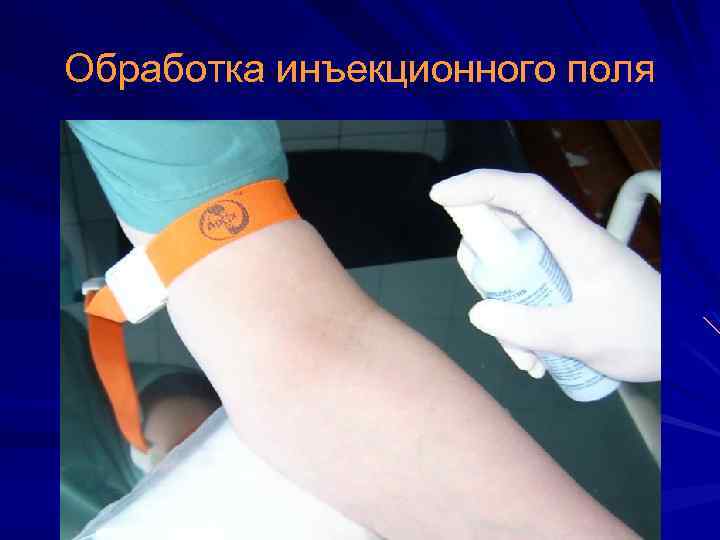 Обработка инъекционного поля 