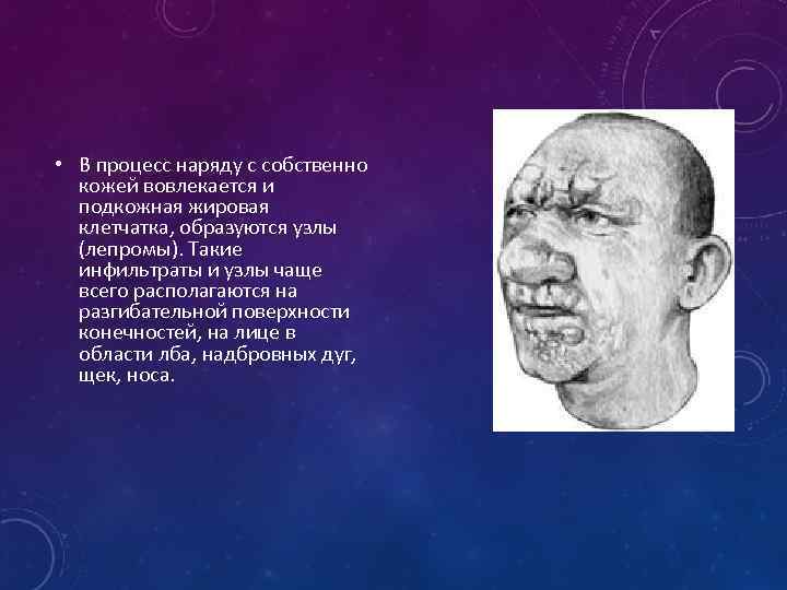  • В процесс наряду с собственно кожей вовлекается и подкожная жировая клетчатка, образуются