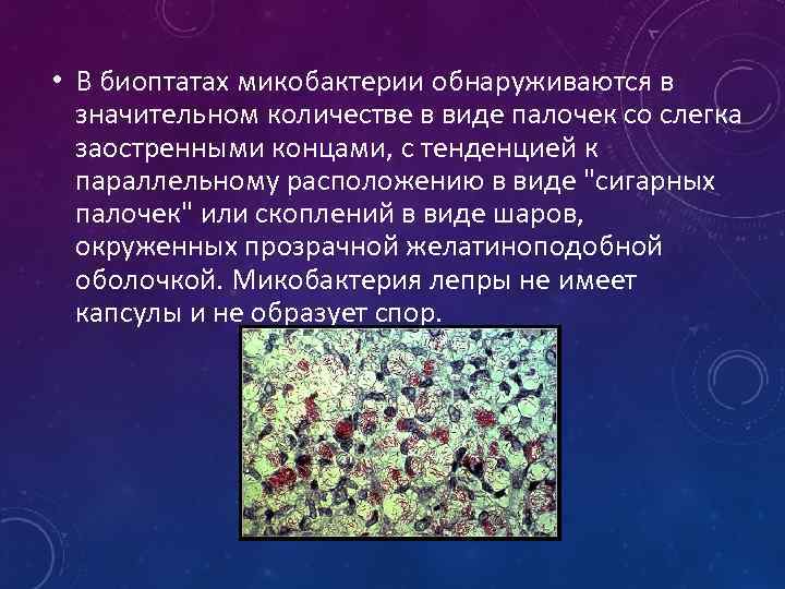  • В биоптатах микобактерии обнаруживаются в значительном количестве в виде палочек со слегка