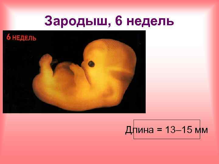 Зародыш, 6 недель Длина = 13– 15 мм 