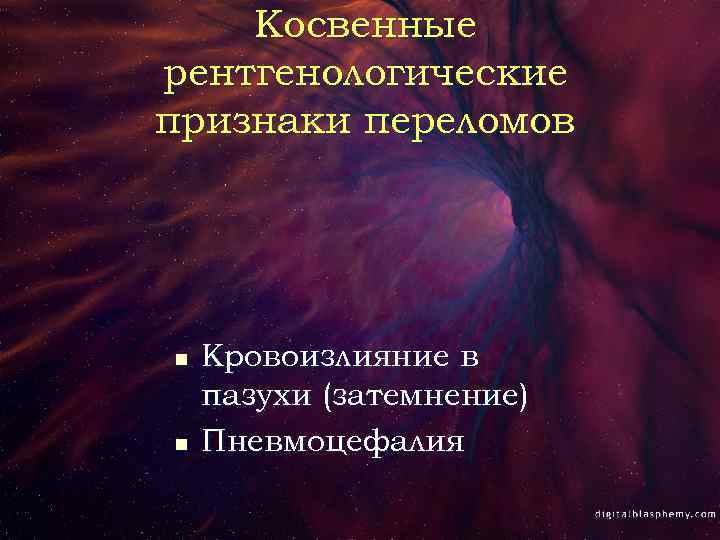 Косвенные рентгенологические признаки переломов n n Кровоизлияние в пазухи (затемнение) Пневмоцефалия 