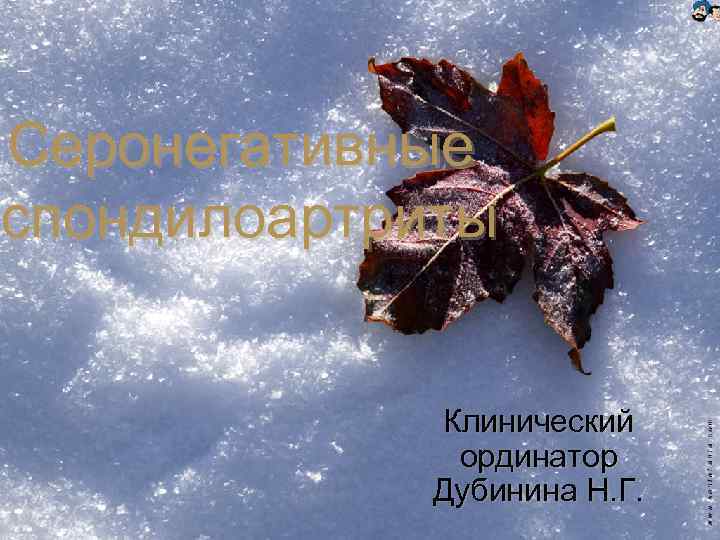 Серонегативные спондилоартриты Клинический ординатор Дубинина Н. Г. 