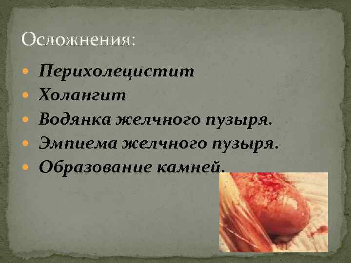 Осложнения: Перихолецистит Холангит Водянка желчного пузыря. Эмпиема желчного пузыря. Образование камней. 