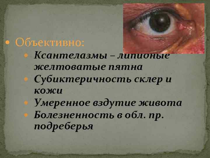  Объективно: Ксантелазмы – липидные желтоватые пятна Субиктеричность склер и кожи Умеренное вздутие живота