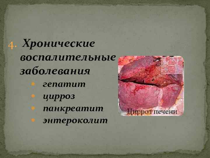 4. Хронические воспалительные заболевания гепатит цирроз панкреатит энтероколит 