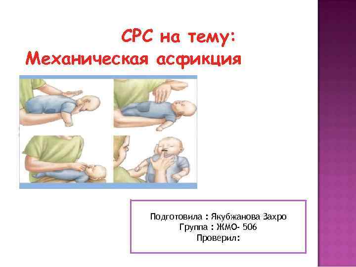 СРС на тему: Механическая асфикция Подготовила : Якубжанова Захро Группа : ЖМО- 506 Проверил: