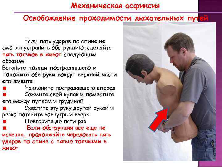 Механическая асфиксия Освобождение проходимости дыхательных путей Если пять ударов по спине не смогли устранить