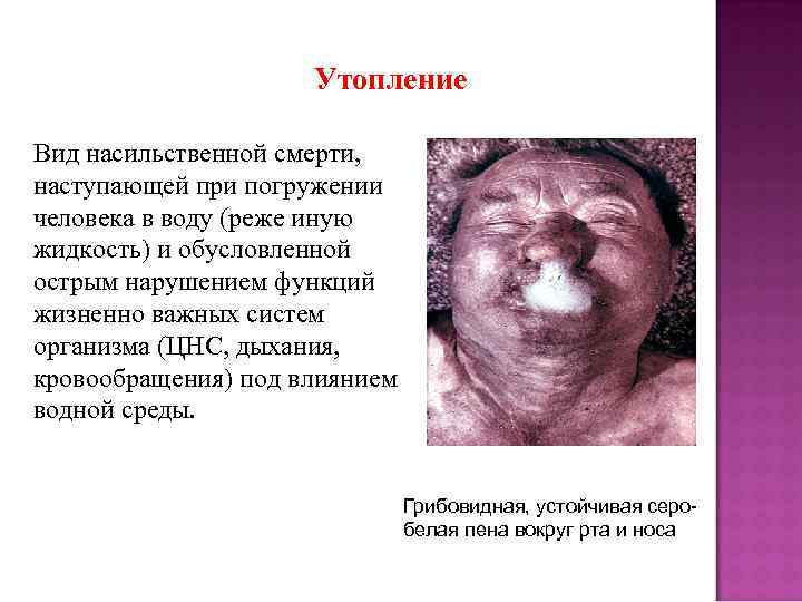 Утопление Вид насильственной смерти, наступающей при погружении человека в воду (реже иную жидкость) и