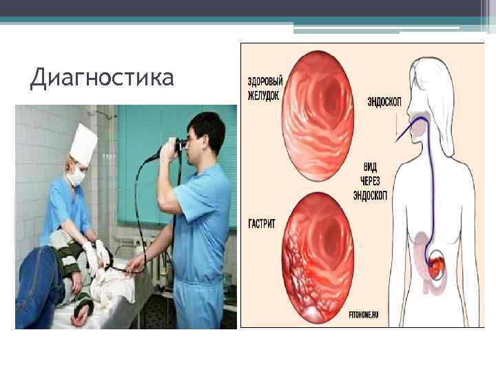 Диагностика 