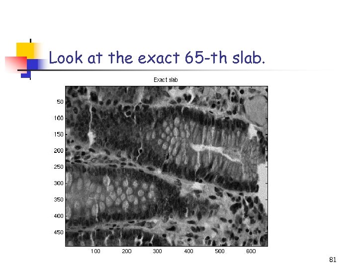 Look at the exact 65 -th slab. 81 