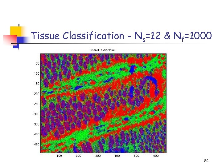 Tissue Classification - Ns=12 & Nf=1000 84 