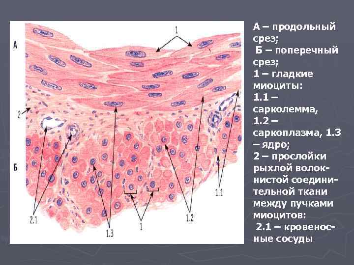 А – продольный срез; Б – поперечный срез; 1 – гладкие миоциты: 1. 1