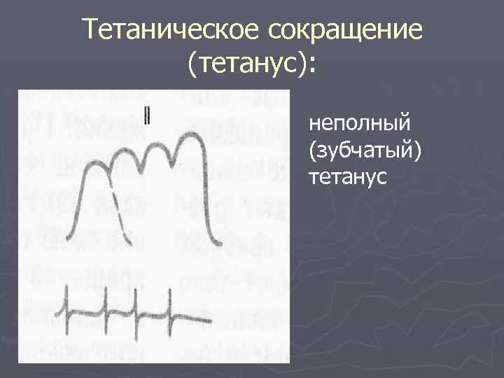 Тетаническое сокращение (тетанус): неполный (зубчатый) тетанус 