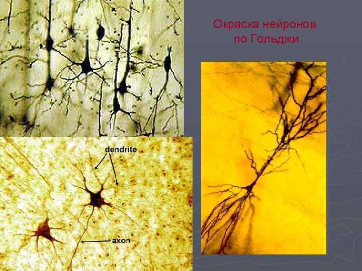 Окраска нейронов по Гольджи 