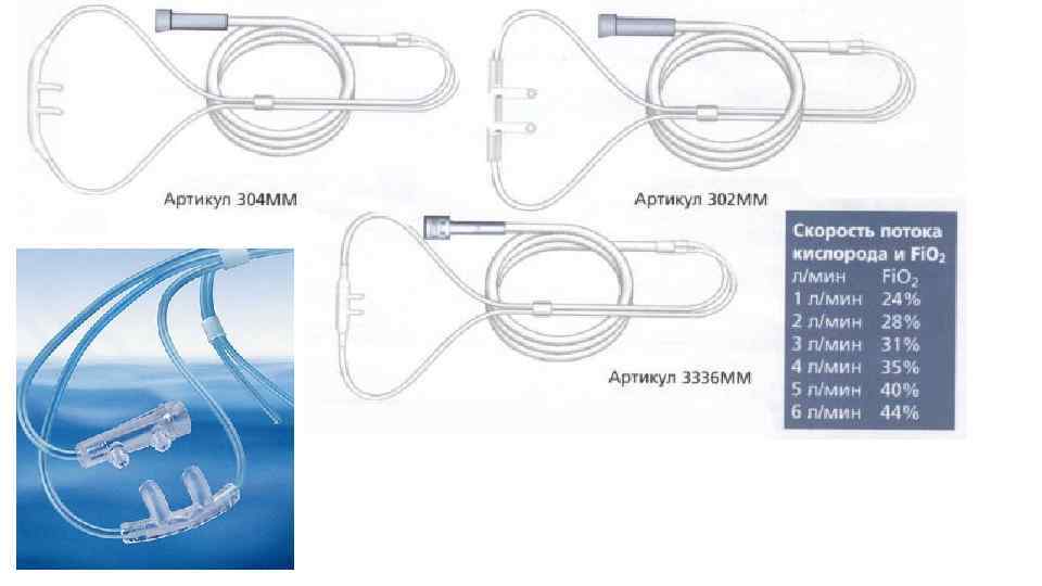 Проведение оксигенотерапии через носовую канюлю алгоритм
