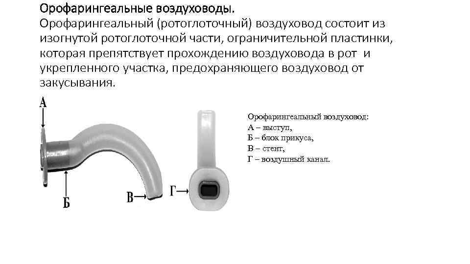 Орофарингеальные воздуховоды. Орофарингеальный (ротоглоточный) воздуховод состоит из изогнутой ротоглоточной части, ограничительной пластинки, которая препятствует