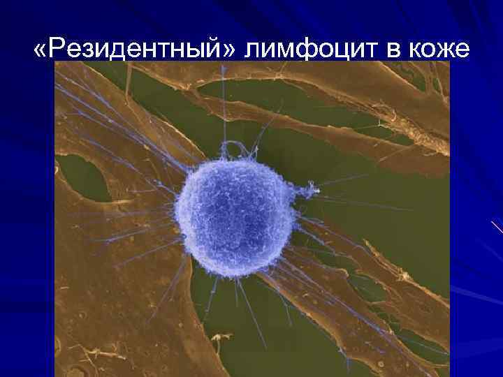  «Резидентный» лимфоцит в коже 