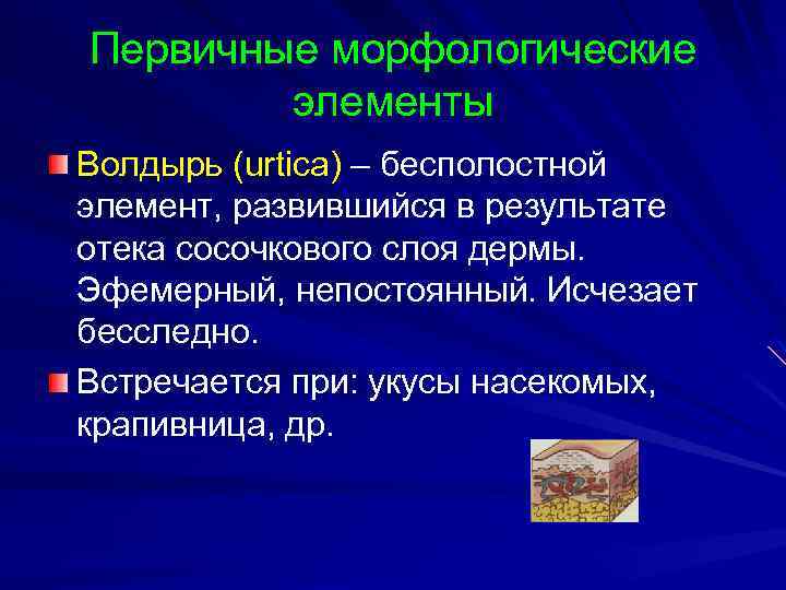 Первичные морфологические элементы Волдырь (urtica) – бесполостной элемент, развившийся в результате отека сосочкового слоя
