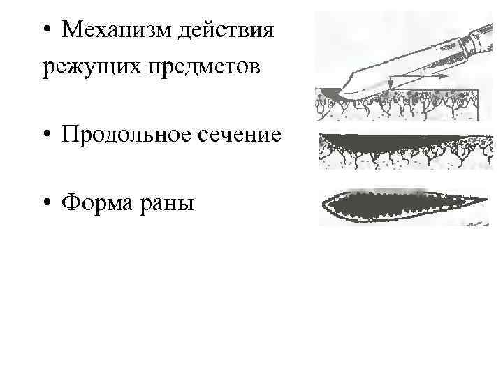  • Механизм действия режущих предметов • Продольное сечение • Форма раны 