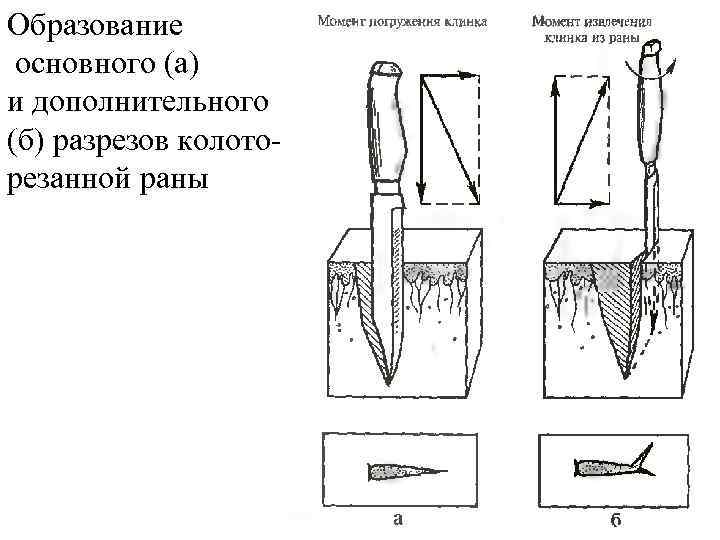 Образование основного (а) и дополнительного (б) разрезов колоторезанной раны 