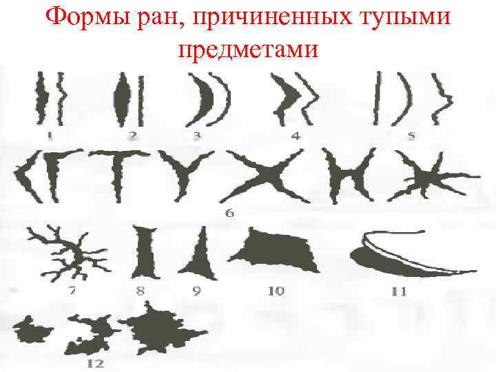 Карта раны. Форма раны тупым предметом. Веретенообразная форма раны.