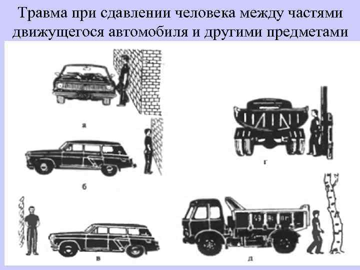 Травма при сдавлении человека между частями движущегося автомобиля и другими предметами 