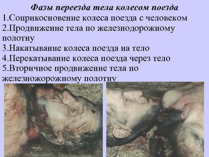 Фазы переезда тела колесом поезда 1. Соприкосновение колеса поезда с человеком 2. Продвижение тела