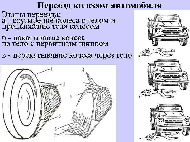 Диагностическим признаком переезда через тело колеса автомобильного транспортного средства является