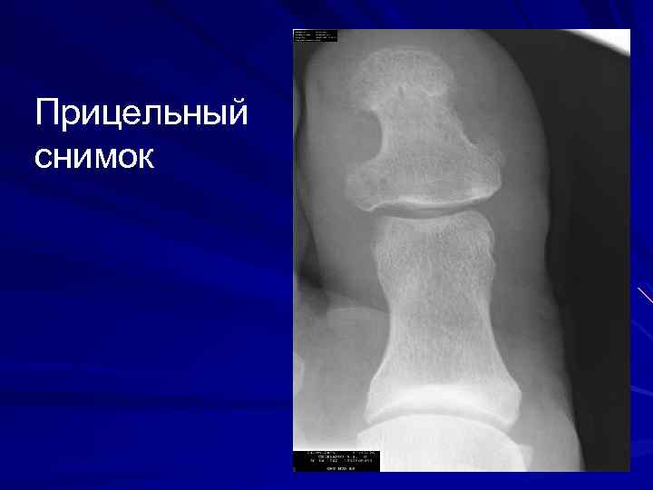 Прицельный снимок 