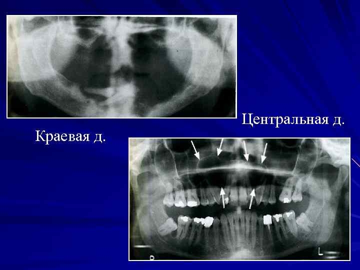 Краевая д. Центральная д. 