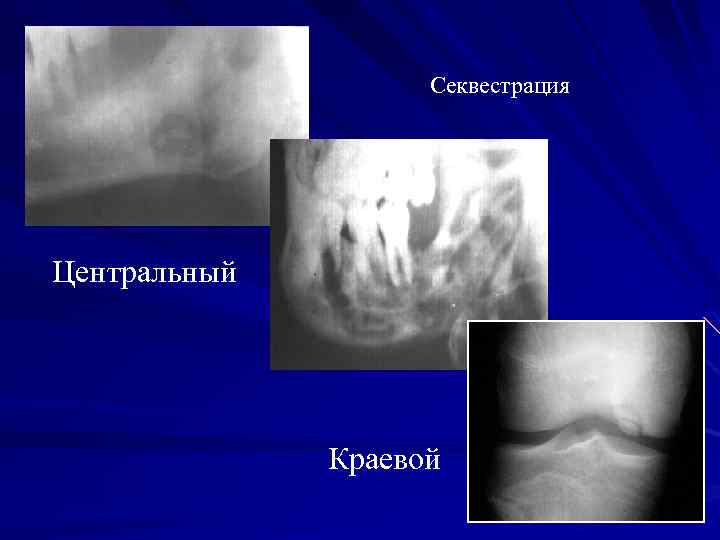 Секвестрация Центральный Краевой 