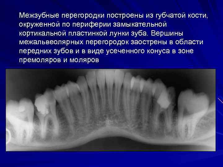 Межзубные перегородки построены из губчатой кости, окруженной по периферии замыкательной кортикальной пластинкой лунки зуба.