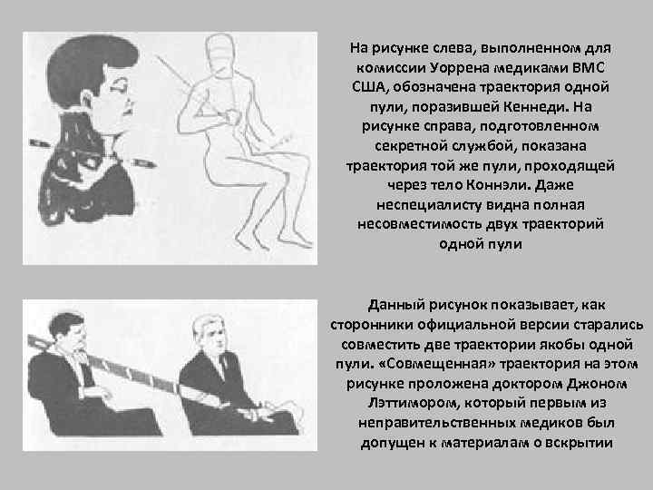 На рисунке слева, выполненном для комиссии Уоррена медиками ВМС США, обозначена траектория одной пули,