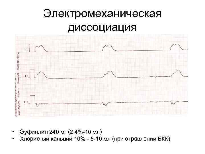 Электромеханическая диссоциация • Эуфиллин 240 мг (2, 4%-10 мл) • Хлористый кальций 10% -