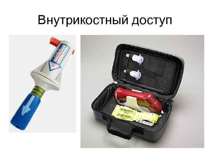 Внутрикостный доступ 