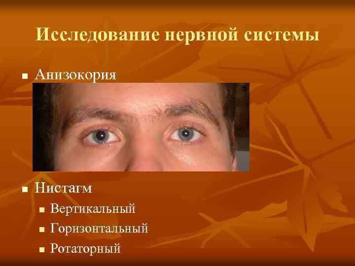 Исследование нервной системы n Анизокория n Нистагм n n n Вертикальный Горизонтальный Ротаторный 