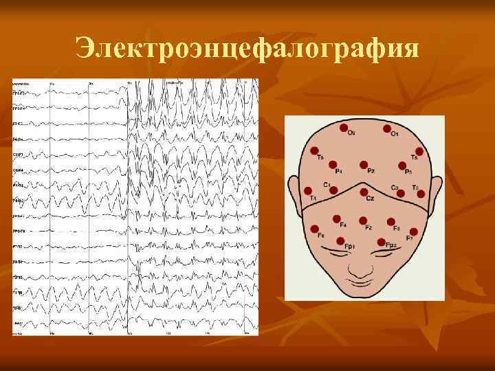 Электроэнцефалография 